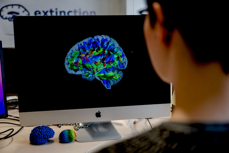 Neurowissenschaft-Imaging