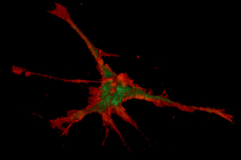 Neurone Neurone
