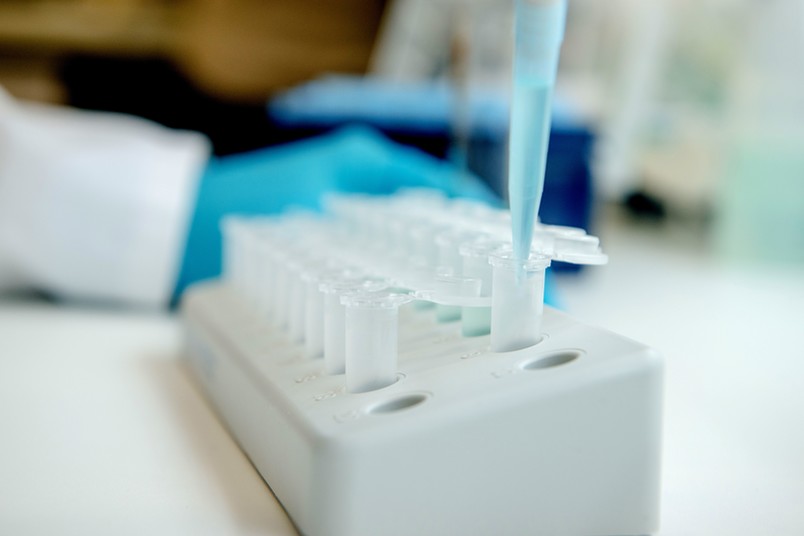Pipettieren Pipettieren